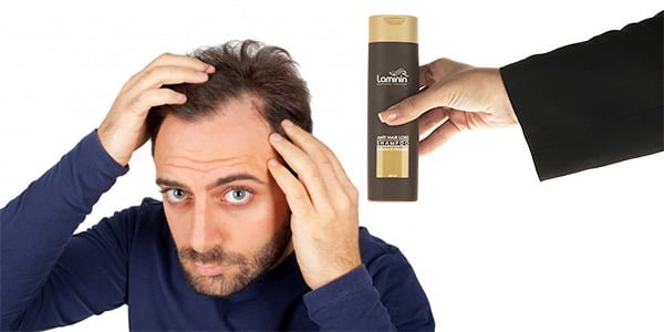 زمان مصرف شامپو ماینوکسیدیل