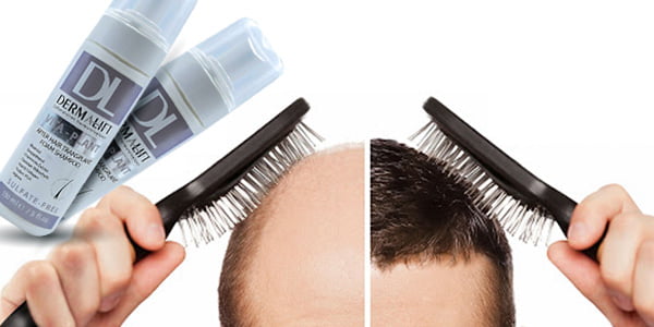 ویتاپلنت درمالیفت