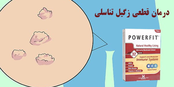 قرص پاورفیت برای درمان زگیل تناسلی
